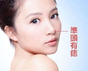 下巴有痣好不好_下巴有痣图解,第3张 下巴有痣好不好_下巴有痣图解,第3张